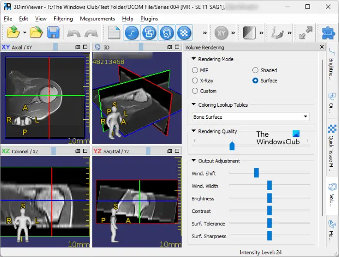 3DimViewer DICOM Viewer software 3DimViewer DICOM Viewer software