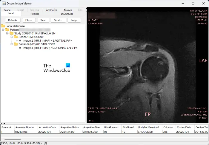 DICOM Image Viewer DICOM Image Viewer
