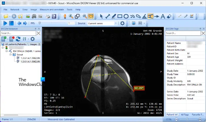 MicoDicom free DICOM viewer software MicoDicom free DICOM viewer software