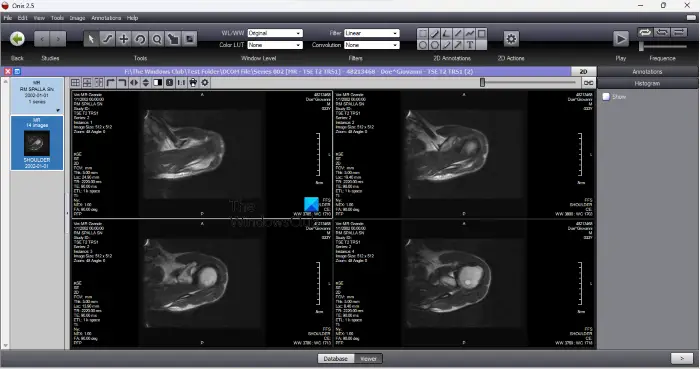 Onis DICOM Viewer Onis DICOM Viewer