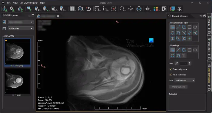 Weasis free DICOM Viewer software Weasis free DICOM Viewer software